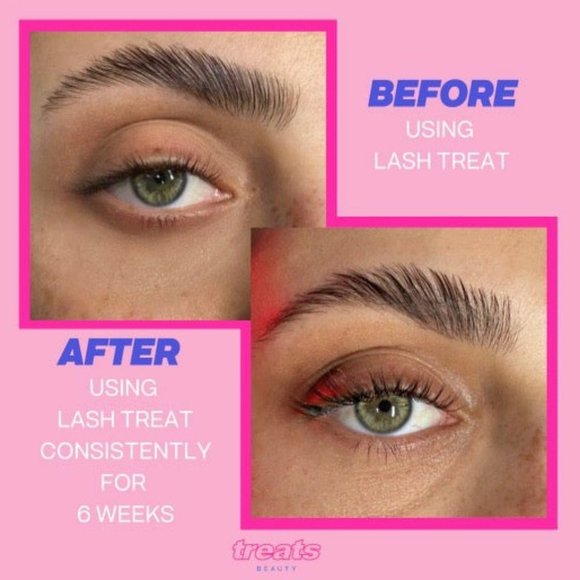 TREATS BEAUTY  Lash Treat Lash Serum $70 - Picture 7 of 7